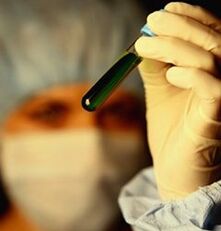 si të testoheni për parazitë